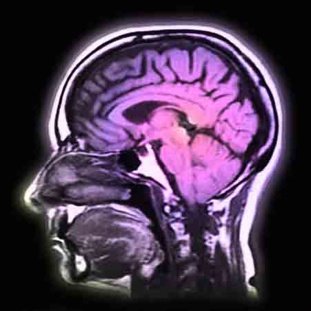 magnetic resonance imaging