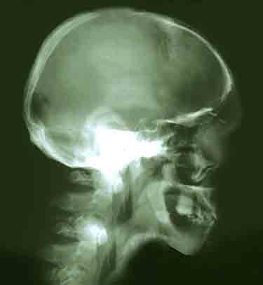 x-ray photography